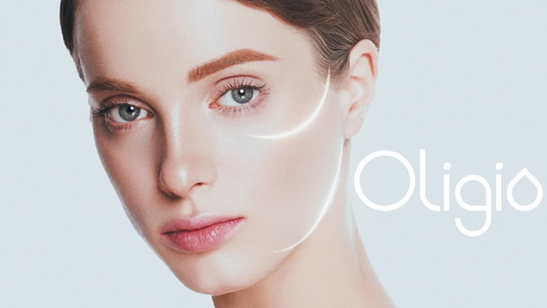 термолифтинг